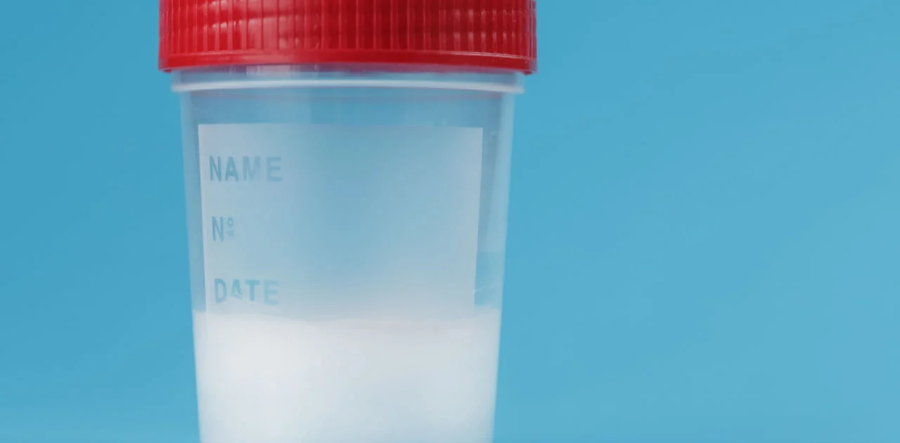 احتقان السائل المنوي