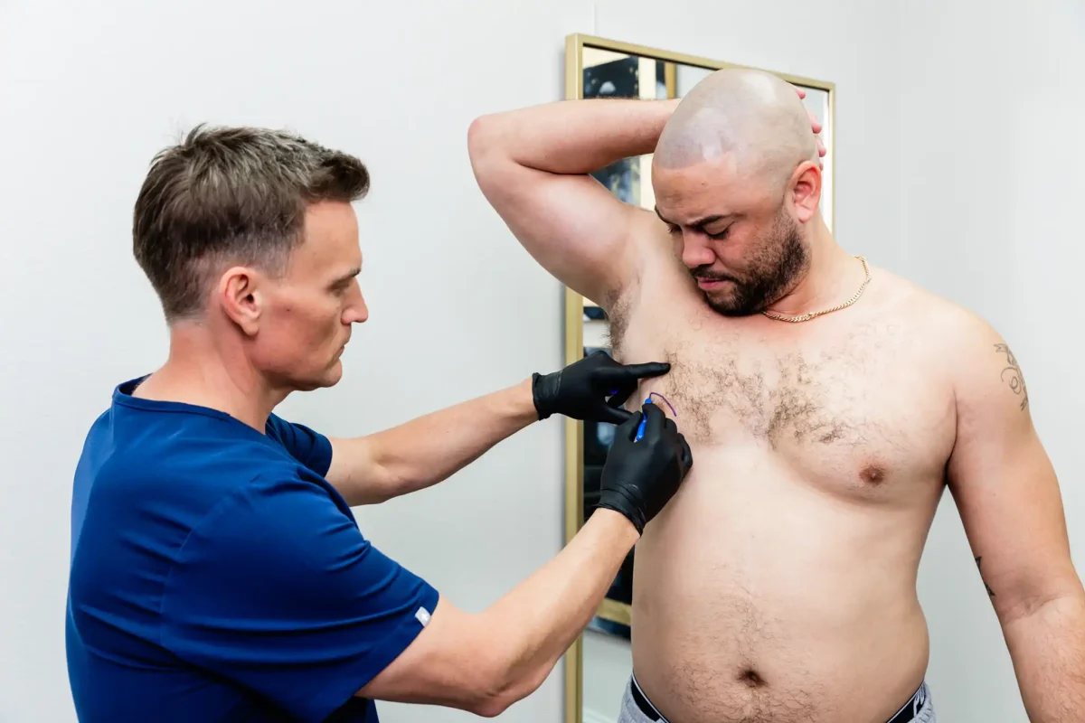 Gynecomastia-1200x800.webp