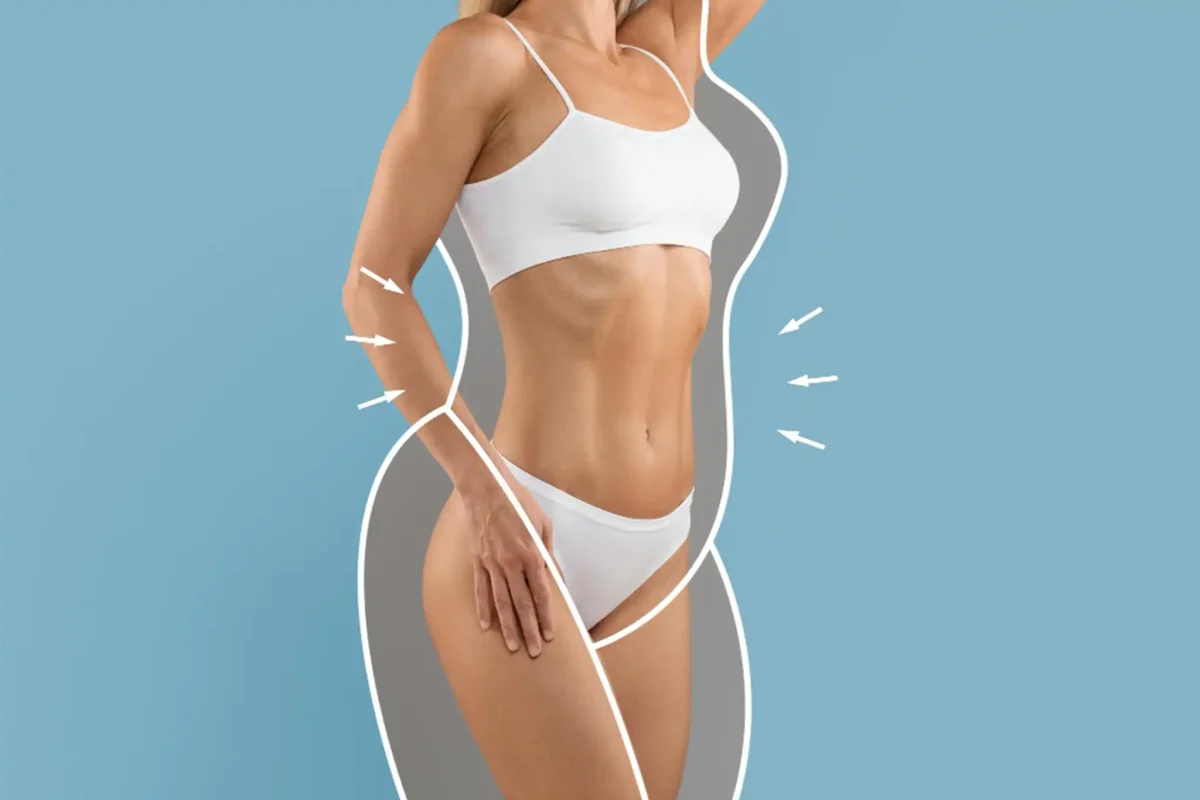 tummy-tuck-1200x800.webp