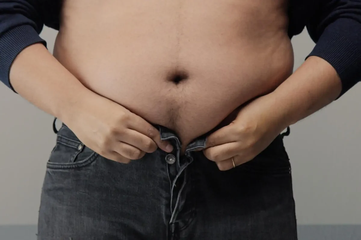 pubic-fat-1200x800.webp